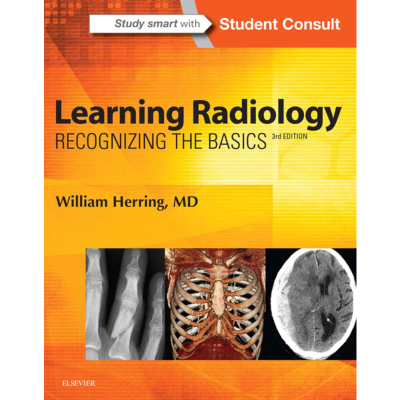 Learning Radiology: Recognizing The Basics / William Herring