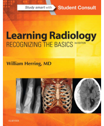Learning Radiology: Recognizing The Basics / William Herring